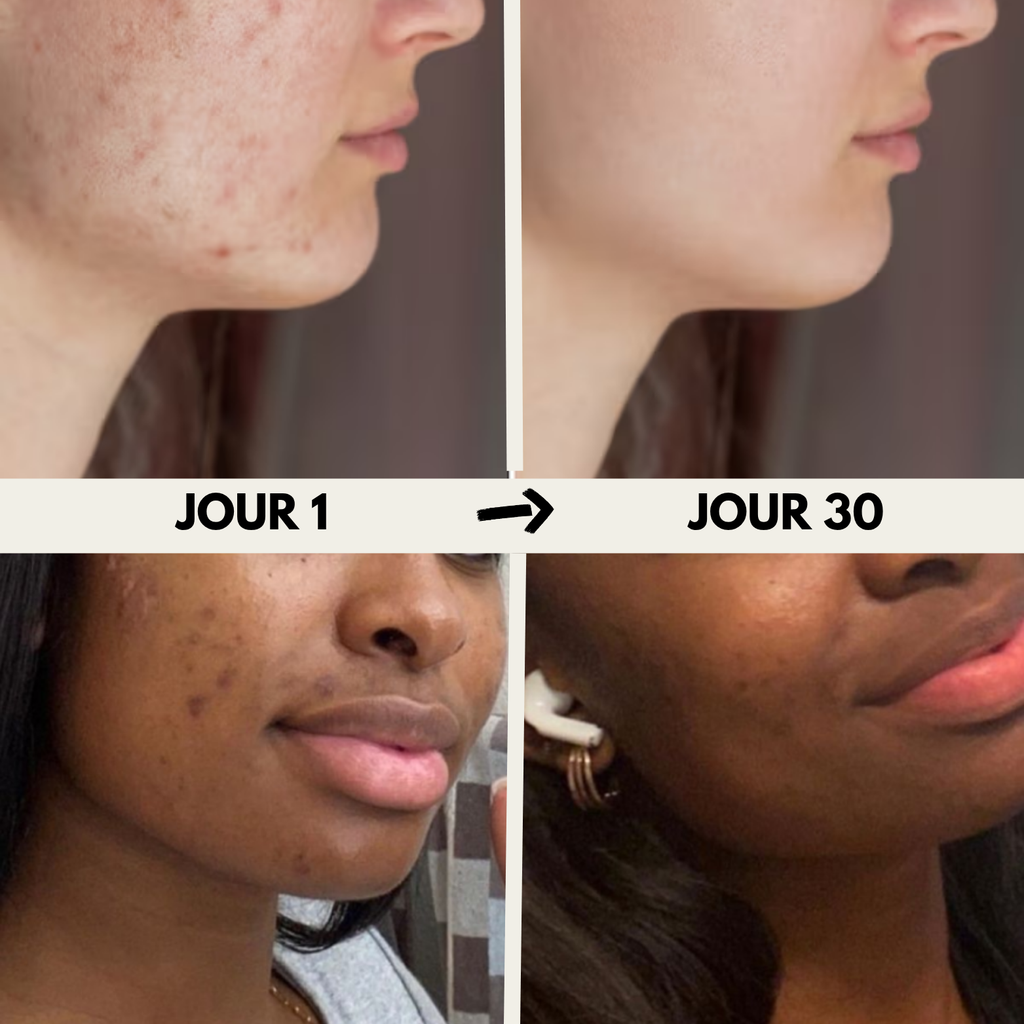 Taie d'oreiller 100% soie de Mûrier