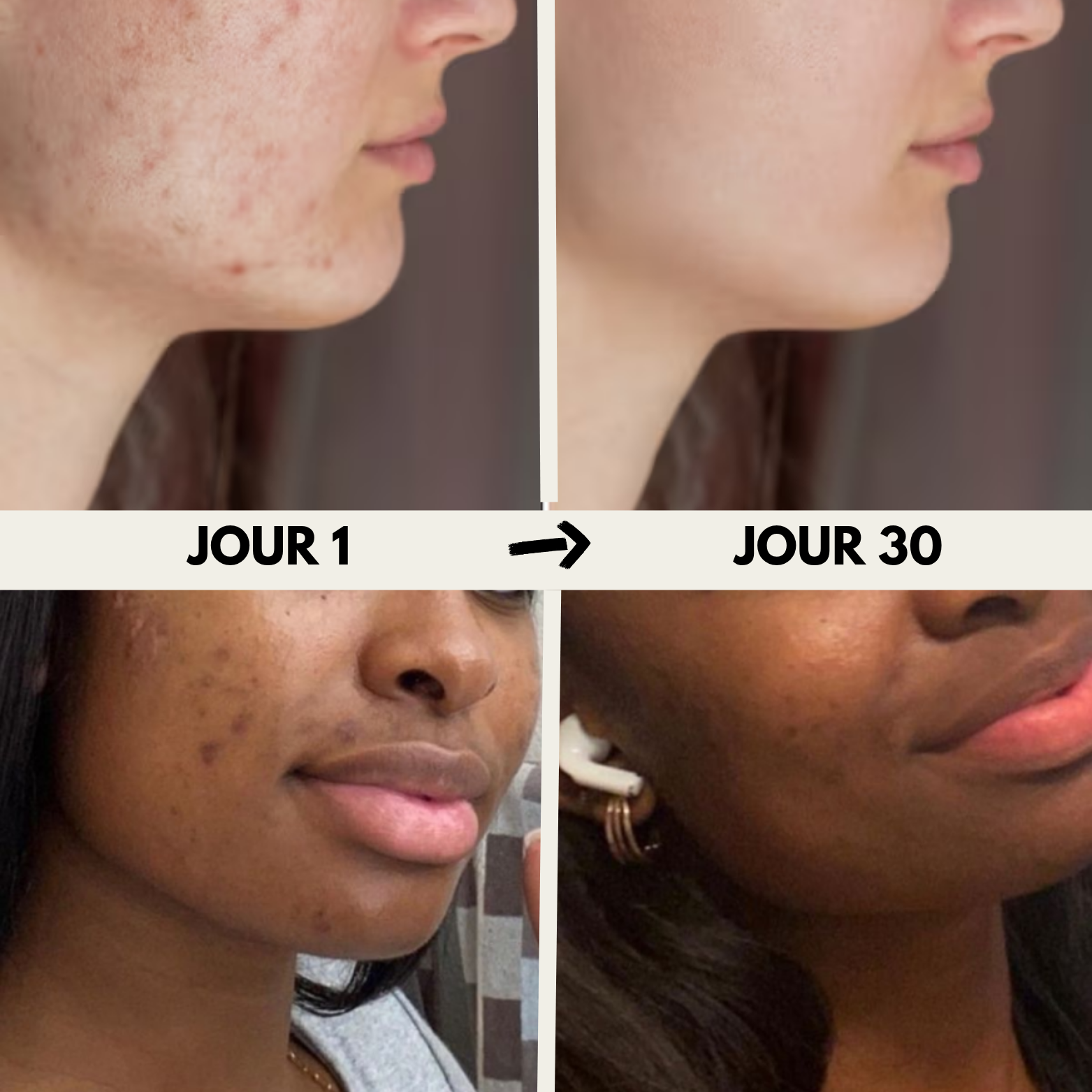 Taie d'oreiller 100% soie de Mûrier